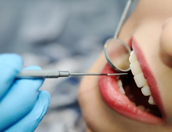Zákoutí dentální hygieny