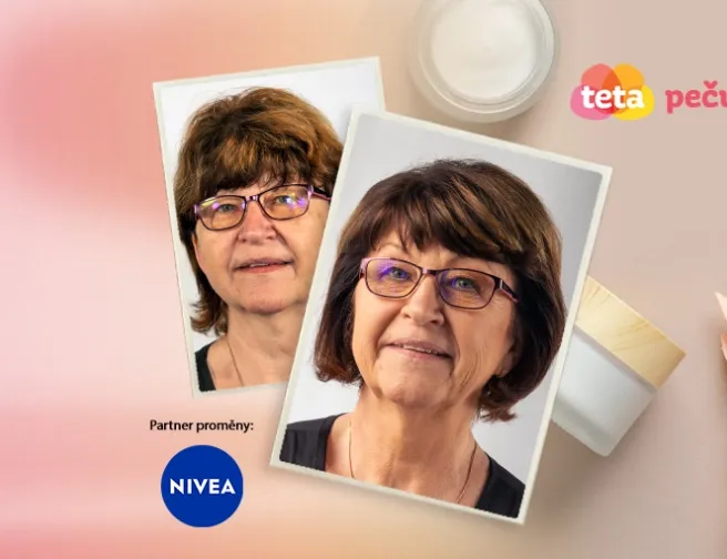 Péče o zralou pleť s pigmentovými skvrnami: Hana (63 let)
