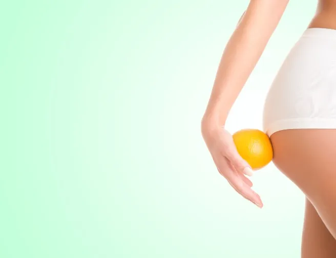 Poraďte si s celulitidou aneb Jak řešit pomerančovou kůži