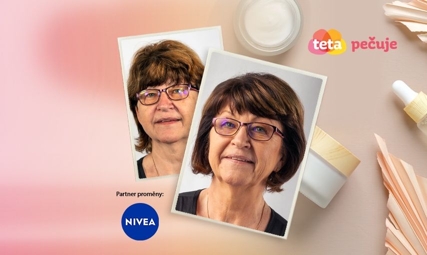 Péče o zralou pleť s pigmentovými skvrnami: Hana (63 let) hlavní banner