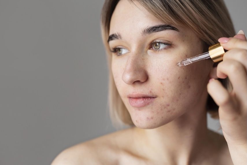 Skincare průvodce: Kyselina salicylová hlavní banner